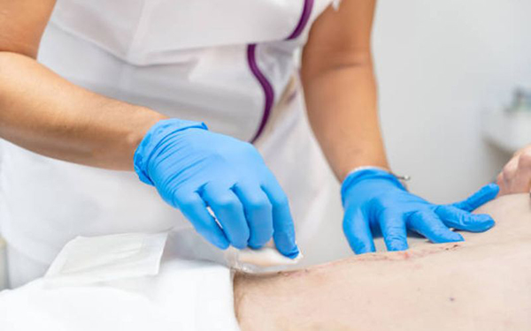 Chăm sóc vết mổ bệnh nhân đúng cách