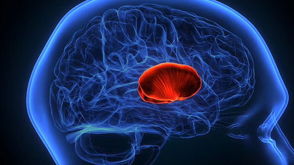 Nguyên nhân gây bệnh đột quỵ